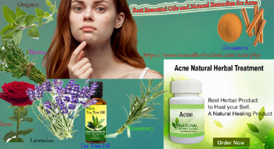 What Are the Best Essential Oils and Natural Remedies for Acne?
