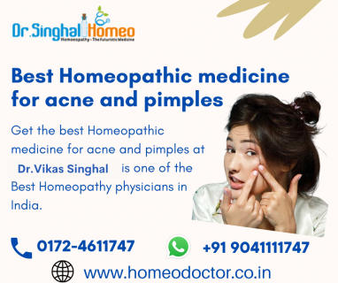 Best Homeopathic medicine for acne and pimples